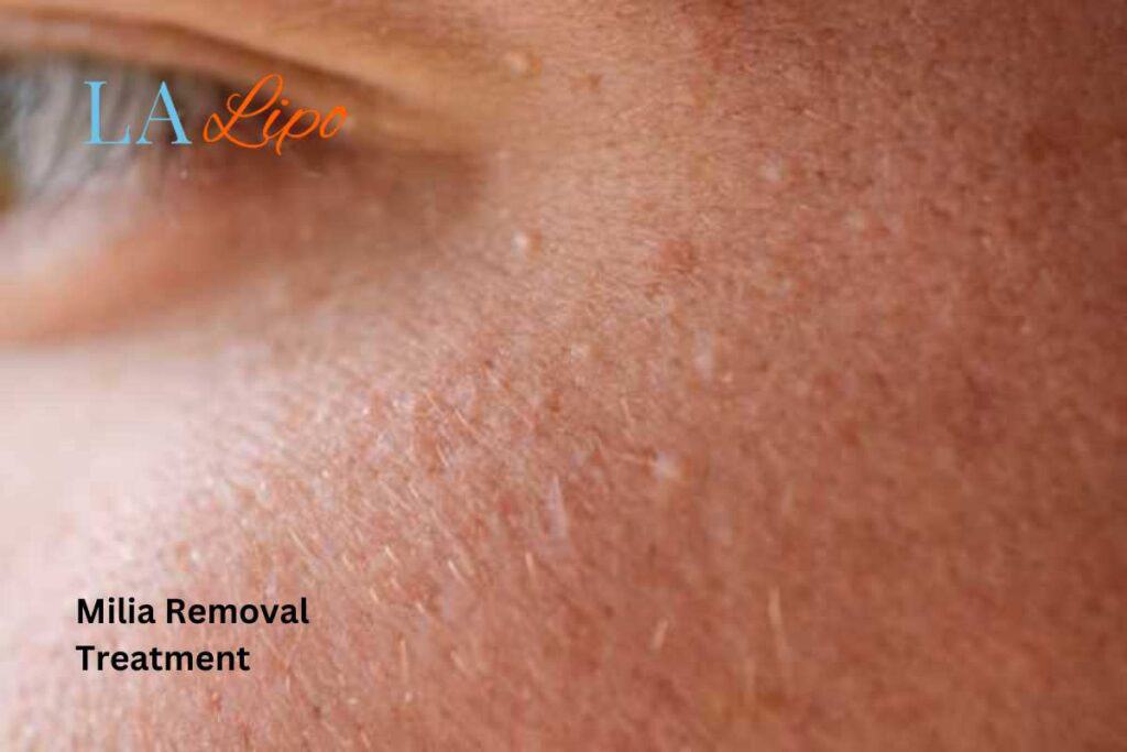 When It’s Time to See a Professional Wilmslow?