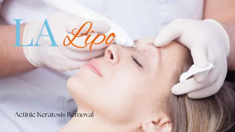 Woman receiving Actinic Keratosis Removal Treatment Wilmslow