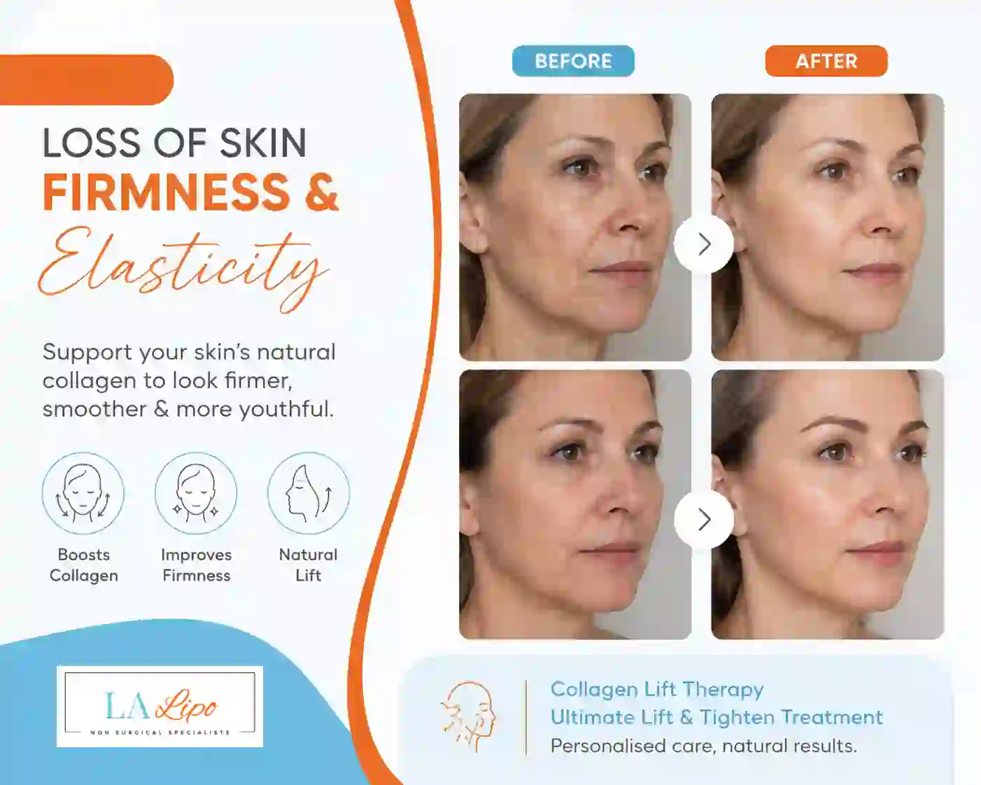 Sign #7: Loss of Skin Firmness and Elasticity Wilmslow
