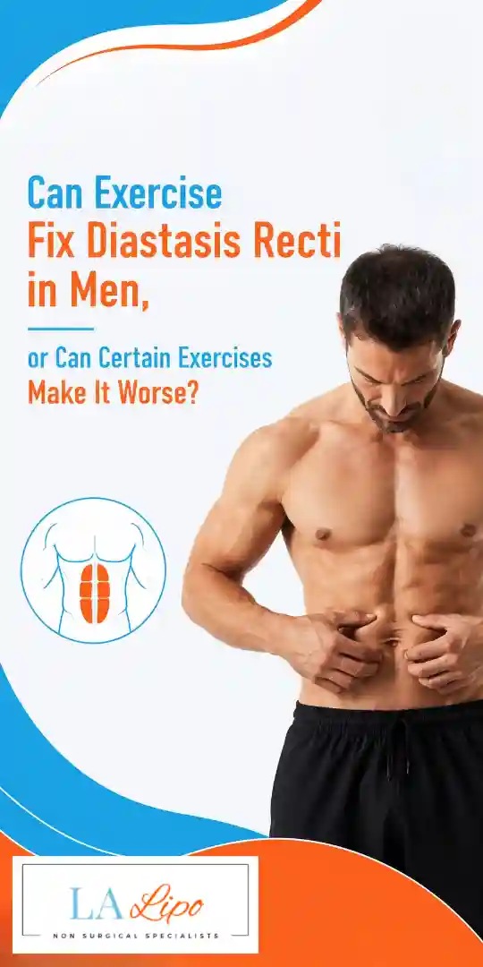 Can Exercise Fix Diastasis Recti in Men, or Can Certain Exercises Make It Worse Wilmslow?